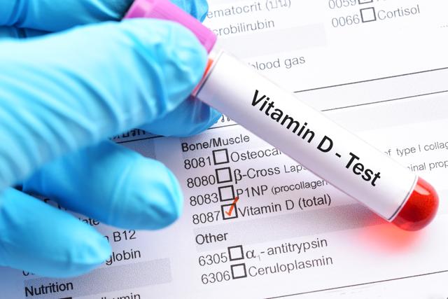 Vitamin D tests are available, but not really necessary (iStock) Vitamin D tests are available, but not really necessary (iStock)