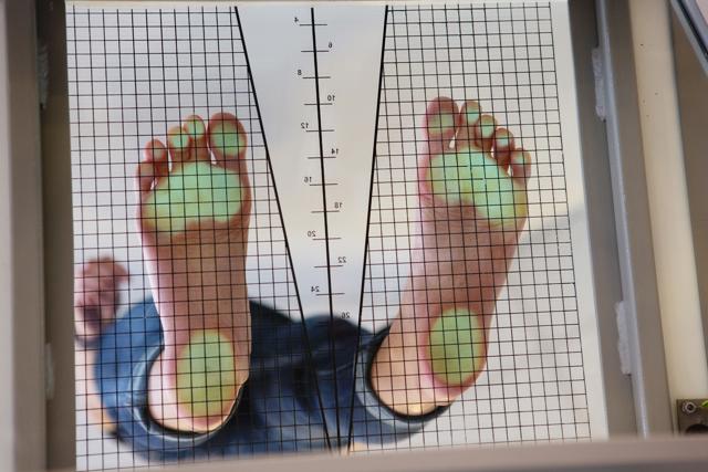 The usual way to check for flat feet is to do the foot print test (Shutterstock) The usual way to check for flat feet is to do the foot print test (Shutterstock)