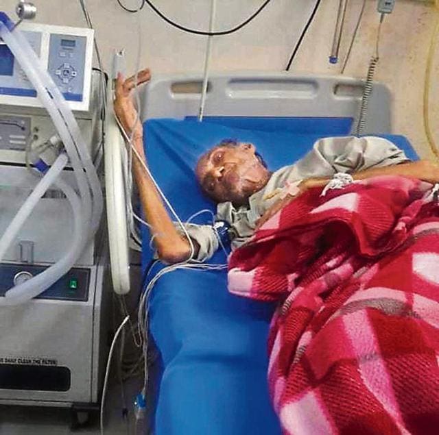 Ashok Jain has now been admitted to a private hospital in Saharanpur after the Saharanpur divisional commissioner came to know about him. (HT Photo ) Ashok Jain has now been admitted to a private hospital in Saharanpur after the Saharanpur divisional commissioner came to know about him. (HT Photo )