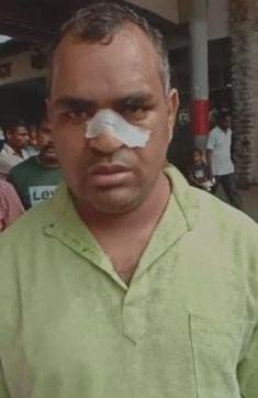 Shivnath, 32, was left with a broken nose.