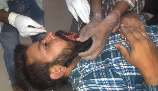 One of the injured getting treated at the Ludhiana civil hospital on Saturday. (Gurpreet Singh/HT) One of the injured getting treated at the Ludhiana civil hospital on Saturday. (Gurpreet Singh/HT)