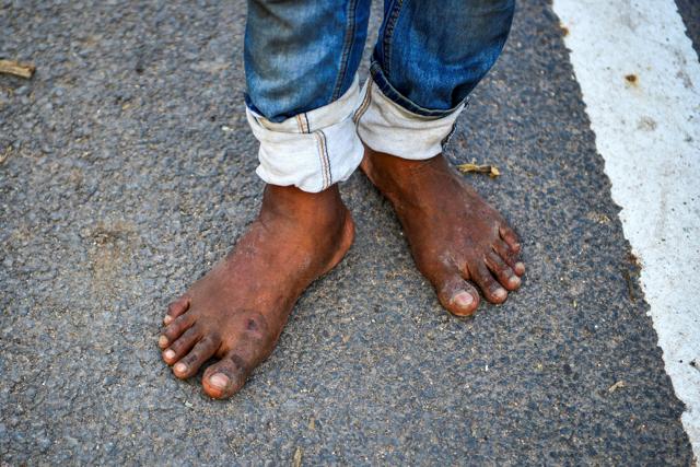 The feet of a migrant worker standing on a street in Allahabad. Picture taken on May 21, 2020, during the nationwide lockdown imposed as a preventive measure against the spread of the COVID-19 coronavirus. (Sanjay Kanojia/AFP) The feet of a migrant worker standing on a street in Allahabad. Picture taken on May 21, 2020, during the nationwide lockdown imposed as a preventive measure against the spread of the COVID-19 coronavirus. (Sanjay Kanojia/AFP)