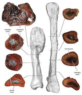 A comparison between thin sections of the cancerous leg bone (L) and normal shin bone of the horned dinosaur Centrosaurus apertus is seen in this image released on August 3, 2020. The fossils were thin sectioned to compare the bone microstructure and properly diagnose the osteosarcoma. Courtesy of Royal Ontario Museum/McMaster University via REUTERS THIS IMAGE HAS BEEN SUPPLIED BY A THIRD PARTY. (via REUTERS)