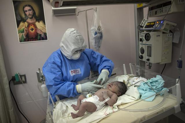 A neonatologist examines a newborn baby at the National Maternal Perinatal Institute in an isolated area reserved for mothers infected with COVID-19, in Lima, Peru, Wednesday, July 29, 2020. The 24-year-old first-time mother wept during her labour not just from pain, but because the baby would be born without her father. The baby's father died from the new coronavirus in June. (AP) A neonatologist examines a newborn baby at the National Maternal Perinatal Institute in an isolated area reserved for mothers infected with COVID-19, in Lima, Peru, Wednesday, July 29, 2020. The 24-year-old first-time mother wept during her labour not just from pain, but because the baby would be born without her father. The baby's father died from the new coronavirus in June. (AP)