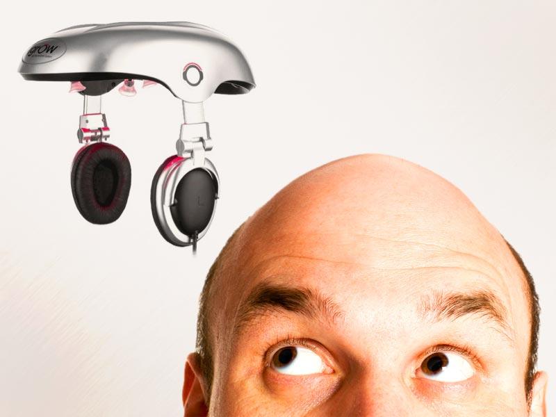 Stress, pollution, poor nutrition and disrupted sleep patterns are key reasons behind premature baldness, which is a problem plaguing people as early as in their twenties. (Shutterstock Photo) Stress, pollution, poor nutrition and disrupted sleep patterns are key reasons behind premature baldness, which is a problem plaguing people as early as in their twenties. (Shutterstock Photo)