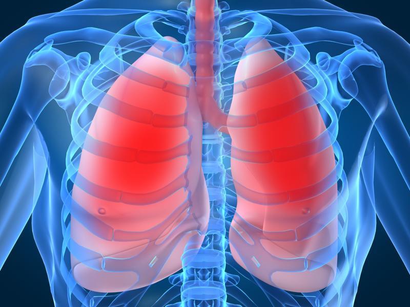 Implanted coils can help some lung patients breathe easy Study