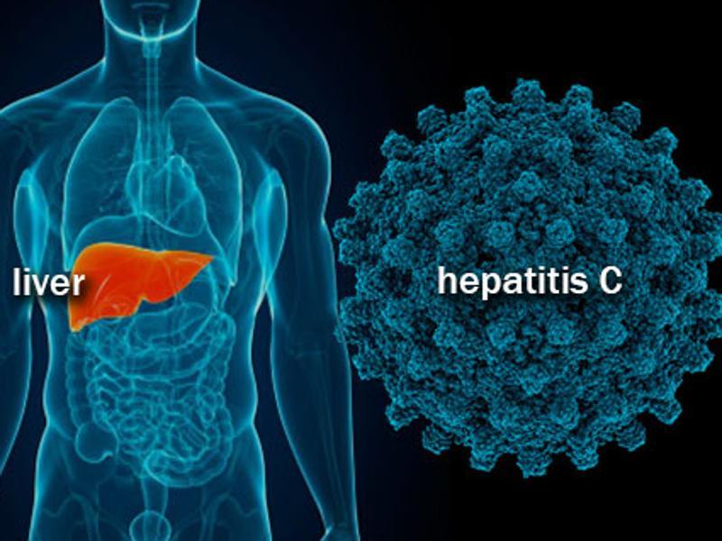 hepatiti