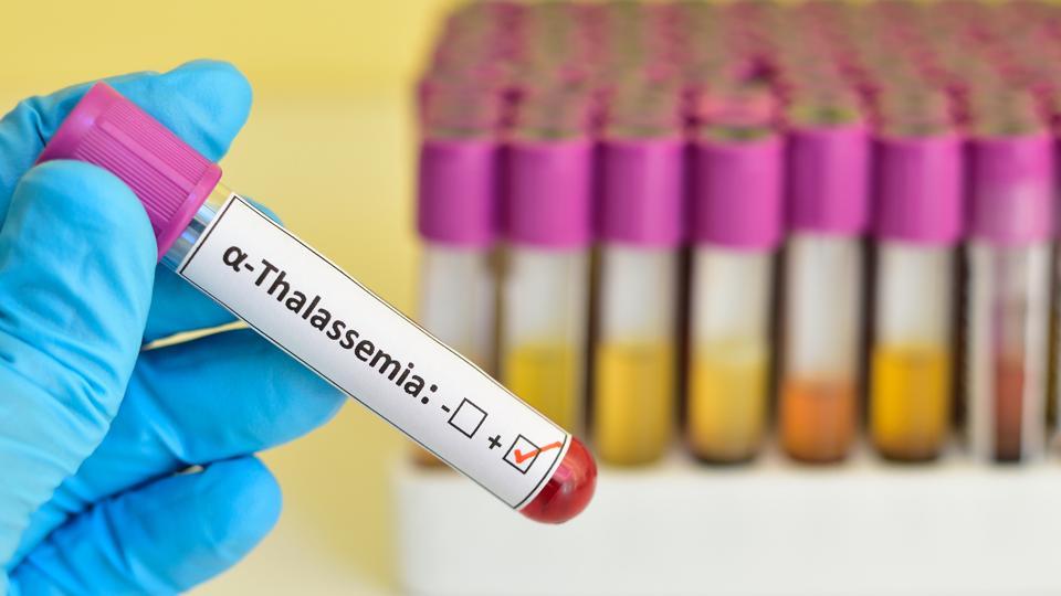 thalassemia minor supplements