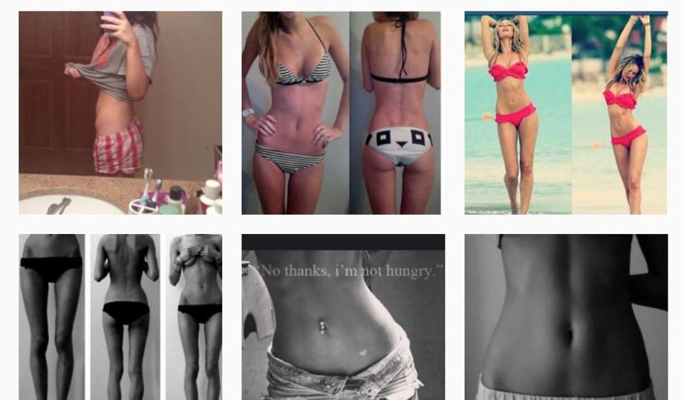 Anorexia,Eating Disorder,Bonespiration,Thinspiration,Extreme Thinness,Insta...