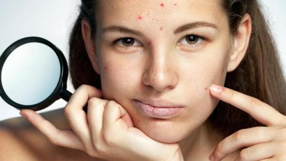 Summer Breakouts Can Happen—Here's How to Treat and Prevent Them