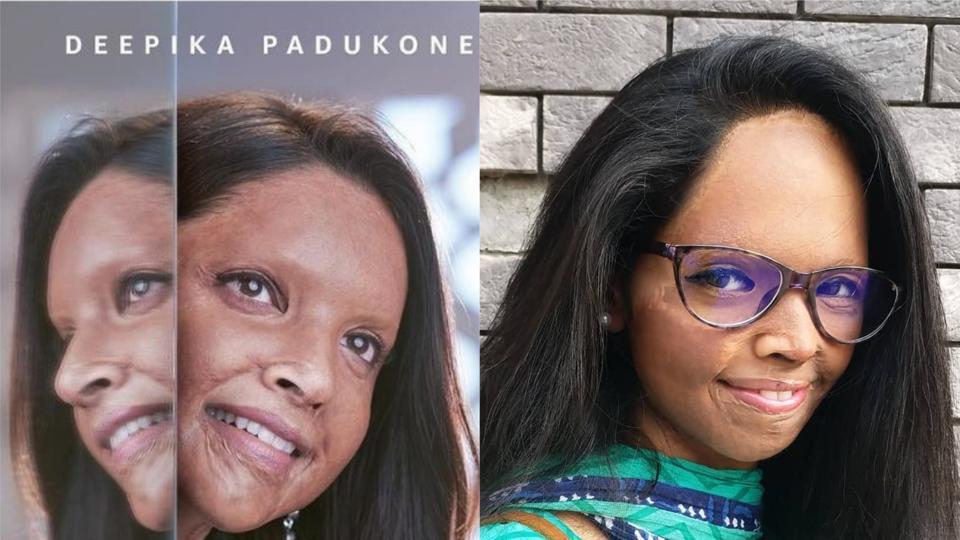 Laxmi Agarwal, who Deepika Padukone plays in Chhapaak, shares how not to talk to an acid attack survivor