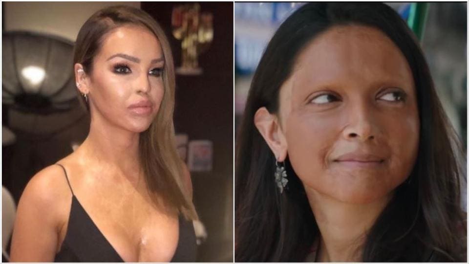 Deepika Padukone’s Chhapaak trailer gets praise from English acid