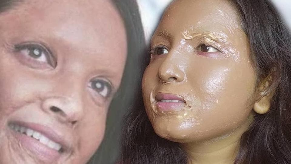 Deepika Padukone’s Chhapaak look has been recreated by this YouTuber. Here’s why it’s purely insensitive and unethical. Watch video