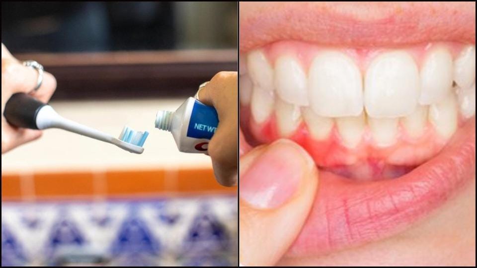 5 myths busted about dental hygiene that are sure to amp up your oral health