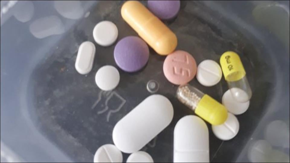 Steroid tablets repeated use may cause diabetes, osteoporosis and