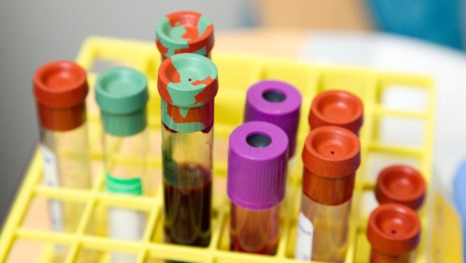 Gut cells get alert when parasites attack, says study ...