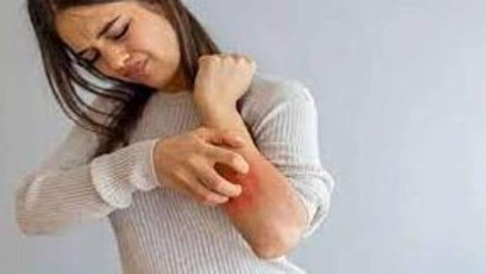 Itch Care தோலில் அரிப்பை நீக்க எளிய வழிமுறைகள்get rid of itching with these effective home