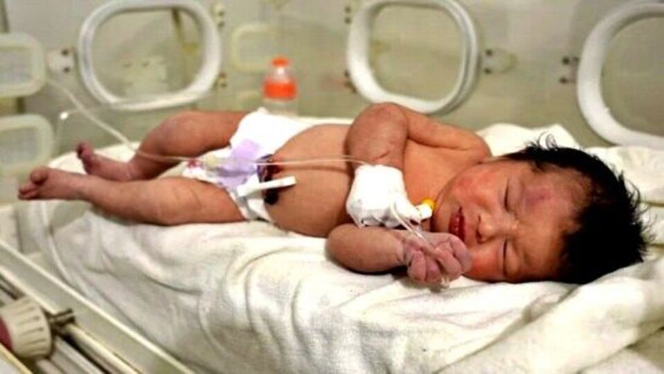 Syrian Baby: நிலநடுக்கத்தில் மீண்ட குழந்தை - தன் மகளாக்கிய மருத்துவர்!