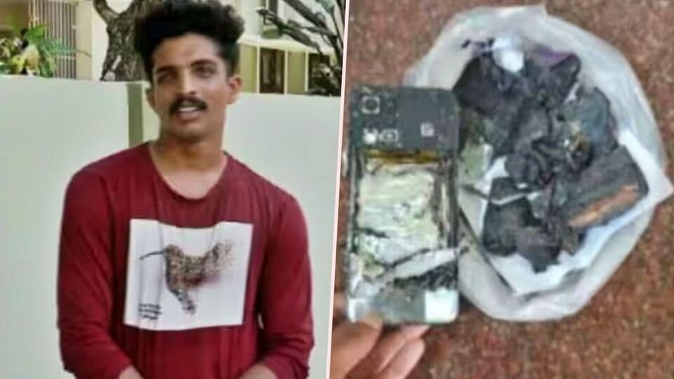 Mobile Phone Explosion பேண்ட் பாக்கெட்டில் வைத்திருந்த செல்போன்