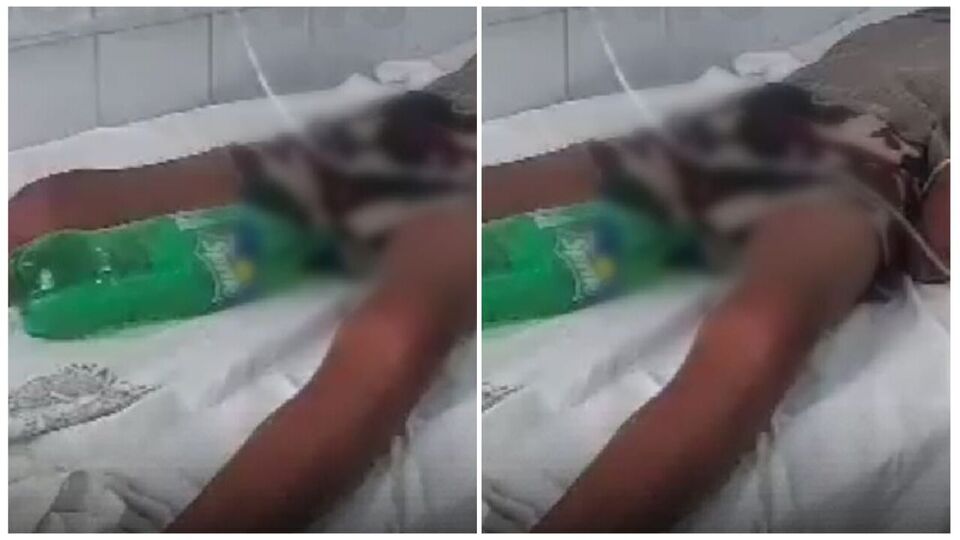 பீகார்.. அவலம் சுயநினைவை இழந்த நோயாளிக்கு சிறுநீர் பைக்கு பதிலாக கூல்டிரிங்ஸ் பாட்டில்!