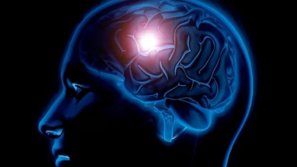 பக்கவாதம் யாருக்கெல்லாம் வரும்? தடுக்க என்ன செய்யலாம்?