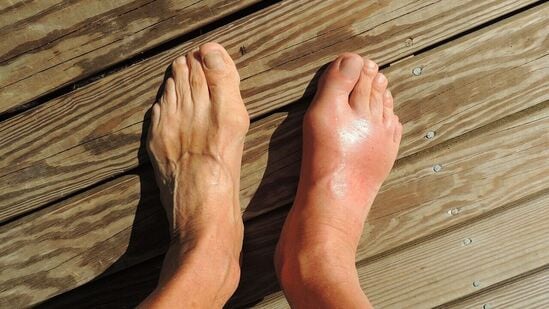 உங்களுக்கு முழங்கால் அல்லது முதுகுவலி இருந்தால்: வெறுங்காலுடன் நடப்பது பாதங்களின் 'செயல்பாட்டில்' குறுக்கிடுகிறது. வெறுங்காலுடன் நடப்பது முழங்கால் மற்றும் முதுகு வலிக்கு வழிவகுக்கும். காலின் பயோமெக்கானிக்கல் செயல்பாடு கூட தொந்தரவு செய்யப்படுகிறது. கடினமான தரையில் வெறுங்காலுடன் நடப்பது பாதங்கள் உட்பட உடலின் மற்ற பகுதிகளுக்கு அதிக அழுத்தத்தை ஏற்படுத்துகிறது. வெறுங்காலுடன் நீண்ட நேரம் நடப்பது உடலின் பல்வேறு பகுதிகளில் வலியை ஏற்படுத்தும்.