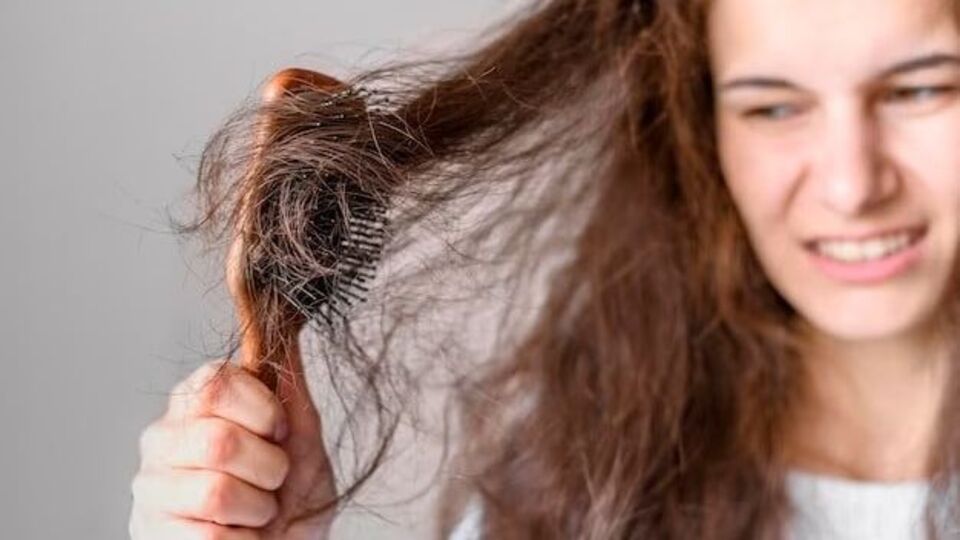 Hair Fall : முடி உதிராது, வேர் பலமாக இருக்கும்! இந்த 4 குறிப்புகளை ஃபலோ பண்ணுங்க போதும்!