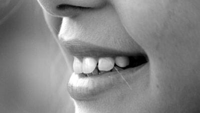 Sensitive Teeth : பற்களில் கூச்சமா? வீட்டிலிருந்தே செய்யக்கூடிய தீர்வுகளை தெரிந்துகொள்ளுங்கள்.