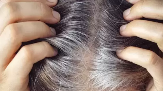 Hair Care Tips : ஆயுர்வேதம் ஒரு பாரம்பரிய இந்திய மருத்துவ முறை ஆகும். முடி முன்கூட்டியே நரைப்பதைக் குறைக்க பல மூலிகை வைத்தியங்கள் உள்ளன. மயிர்க்கால்களுக்கு ஊட்டமளித்து, மெலனின் உற்பத்தியைத் தூண்டி, ஒட்டுமொத்த முடி ஆரோக்கியத்தை மேம்படுத்துவதன் மூலம் இந்த தீர்வுகள் செயல்படுகின்றன.