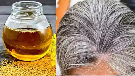 White Hair : நரை முடி எட்டிப்பாக்குதா.. கெமிக்கல் டை வேண்டாம்.. இந்த எண்ணெய்ய பயன்படுத்துங்க.. ரிசல்ட் அட்டகாசம்தா!