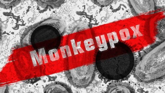 Monkey Pox: கேரளா வரை வந்து விட்ட குரங்கம்மை!உலக சுகாதார நிறுவனத்தின் அறிவுரை என்ன?