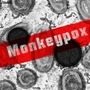 Monkey Pox: கேரளா வரை வந்து விட்ட குரங்கம்மை!உலக சுகாதார நிறுவனத்தின் அறிவுரை என்ன?