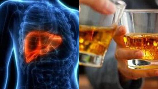 Fatty Liver Disease: மது அருந்தாமல் இருந்தாலும் உங்கள் கல்லீரல் பாதிக்கப்படலாம்..எப்படி தெரியுமா? - விபரம் இதோ..!