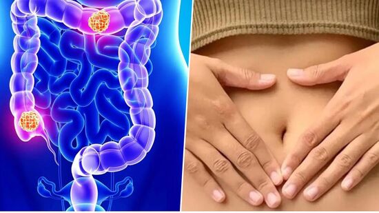 Colon Health: பெருங்குடலுக்கு நண்பனாக இருக்கும் உணவுகள்..தினமும் சாப்பிட்டால் கிடைக்கும் நன்மைகள்