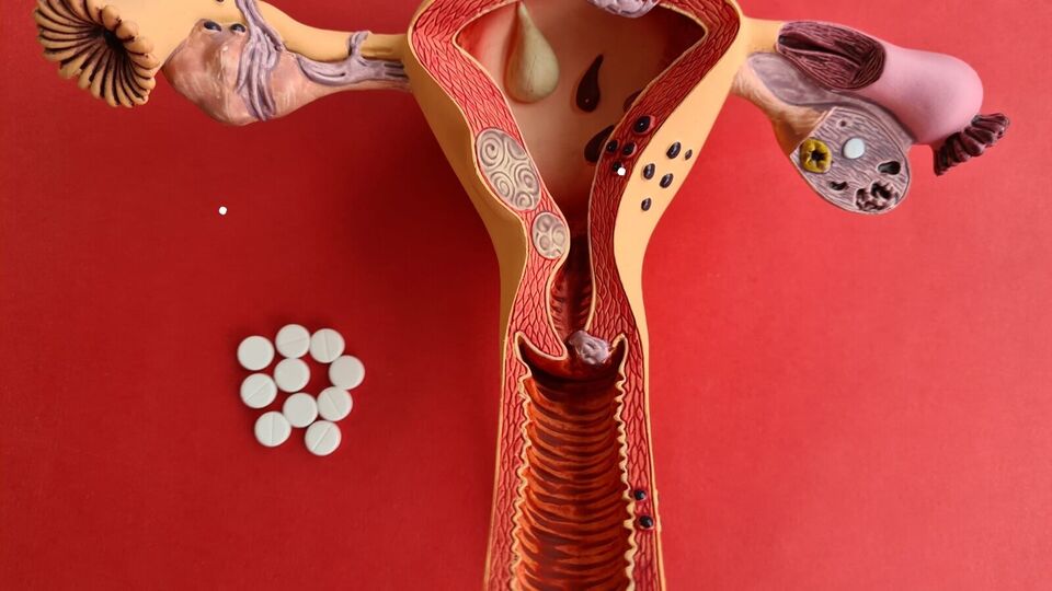 எண்டோமெட்ரியோசிஸ் பாதிக்கப்பட்ட பெண்களின் மன ஆரோக்கியம்! நிபுணர் பகிர்ந்துக் கொள்ளும் முக்கியமான அறிவுரைகள்!