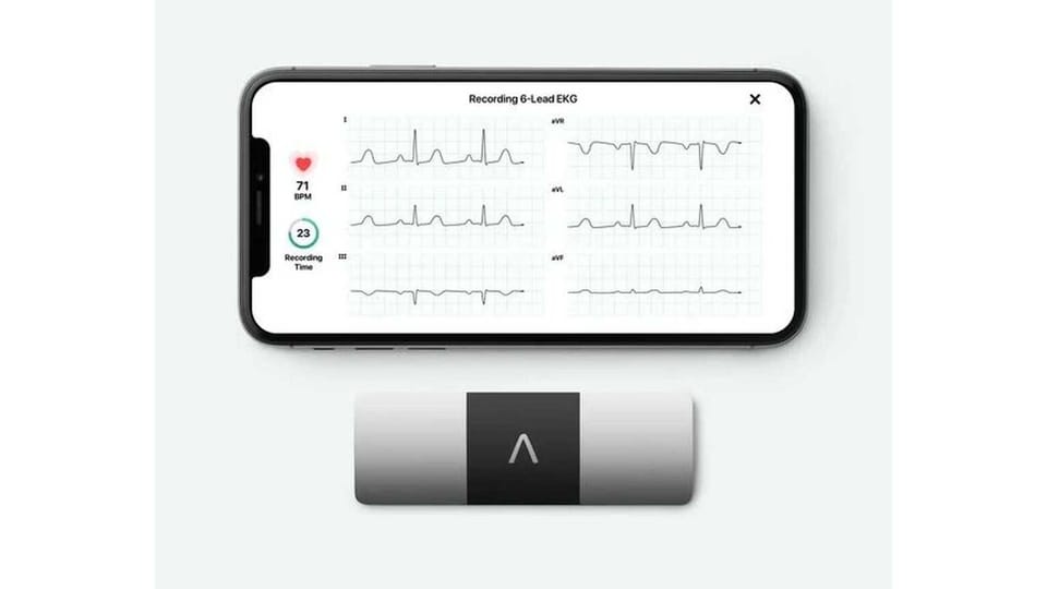 KardiaMobile 6L gives you a 6-lead ECG reading.