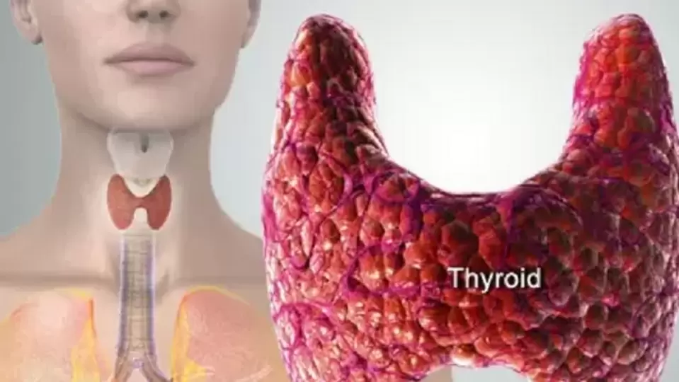 Thyroid