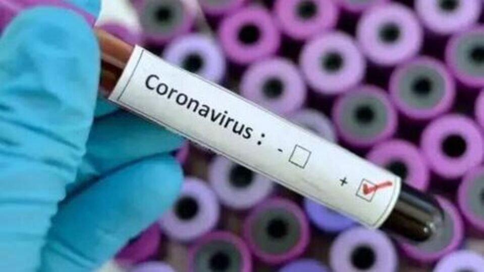 TS Corona Cases తెలంగాణలో భారీగా పెరిగిన కరోనా కేసులు608 new more