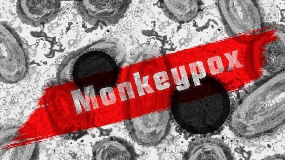 Monkeypox