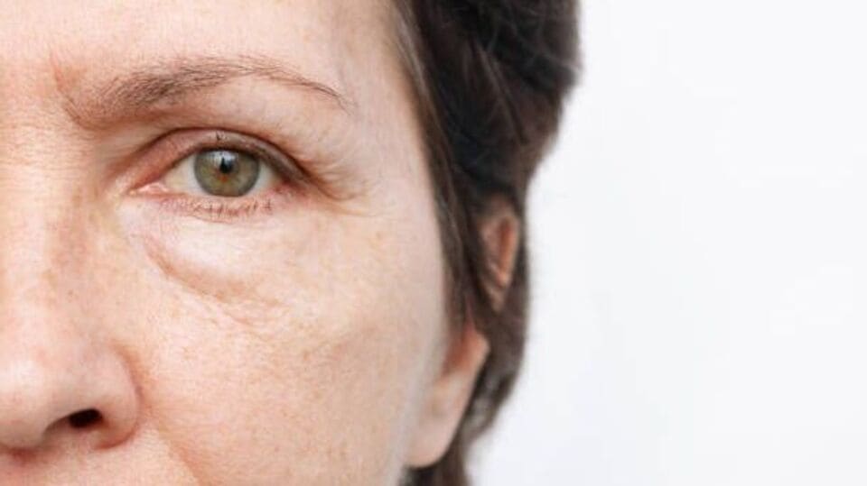 home-remedies-to-get-rid-of-puffy-eye-face-errors-get-rid-of-puffy