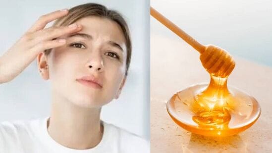 Oily Skin: చర్మం ఎక్కువ జిడ్డుగా అవుతోందా? తేనెను ఈ 5 రకాలుగా వాడితే వదిలేస్తుంది