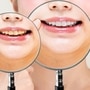 Home remedies for yellow teeth